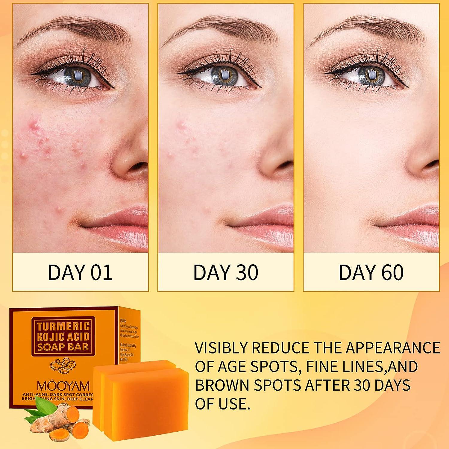 Kojic Acid & Turmeric Soap