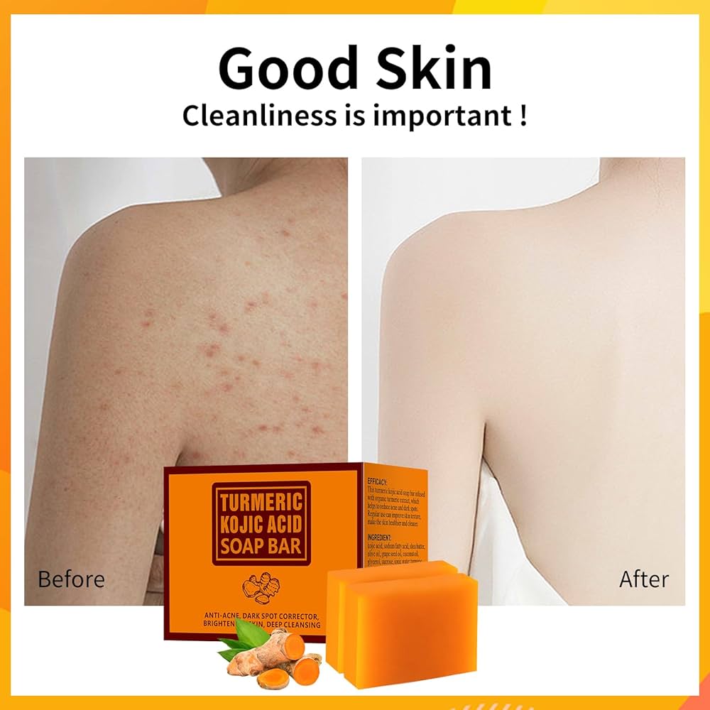 Kojic Acid & Turmeric Soap